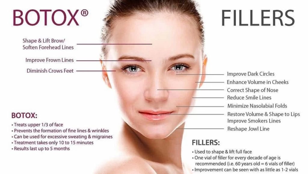 botox-vs-fillers-image-1024x579-1.jpg