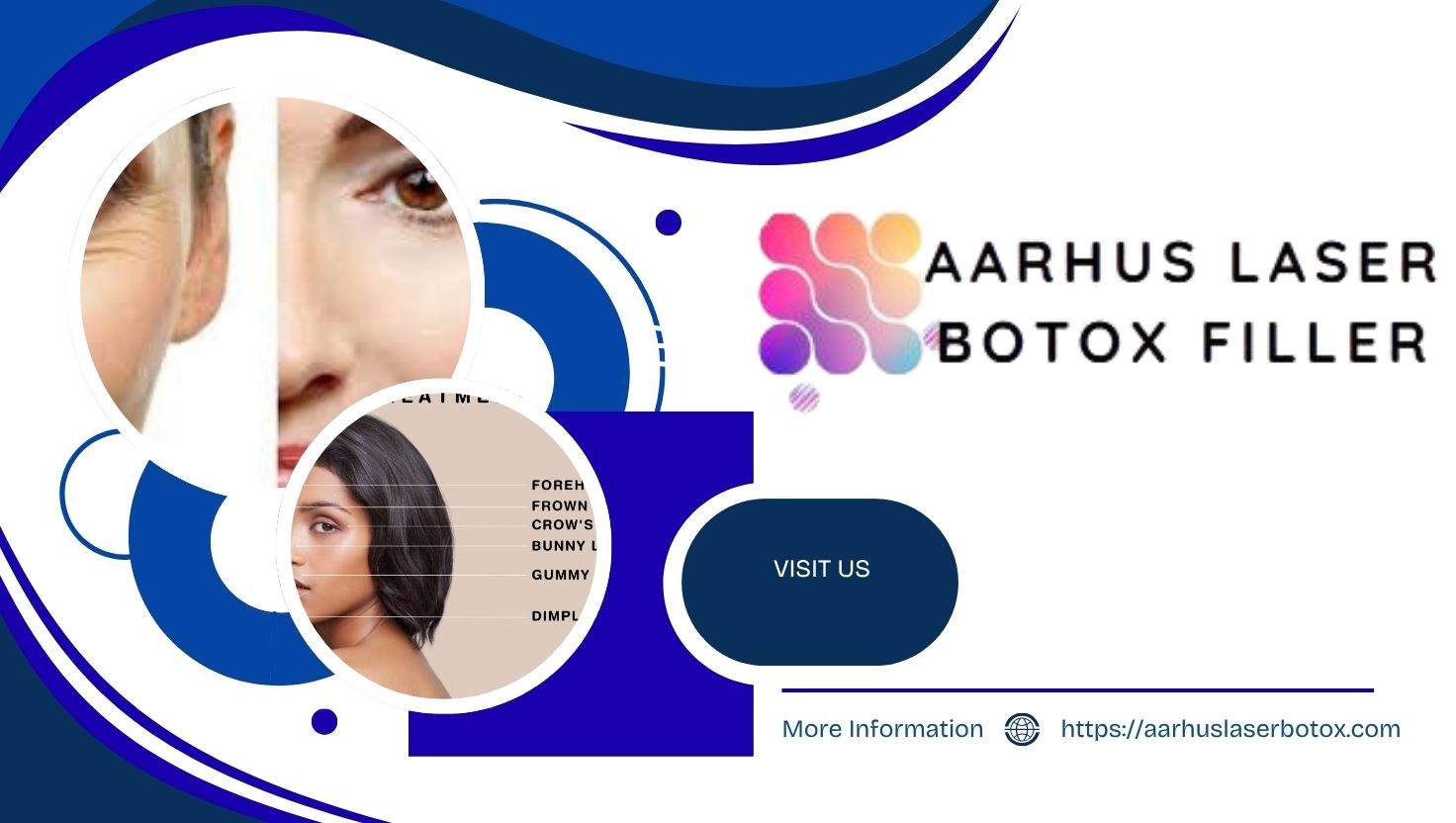 Affordable Botox Near Me