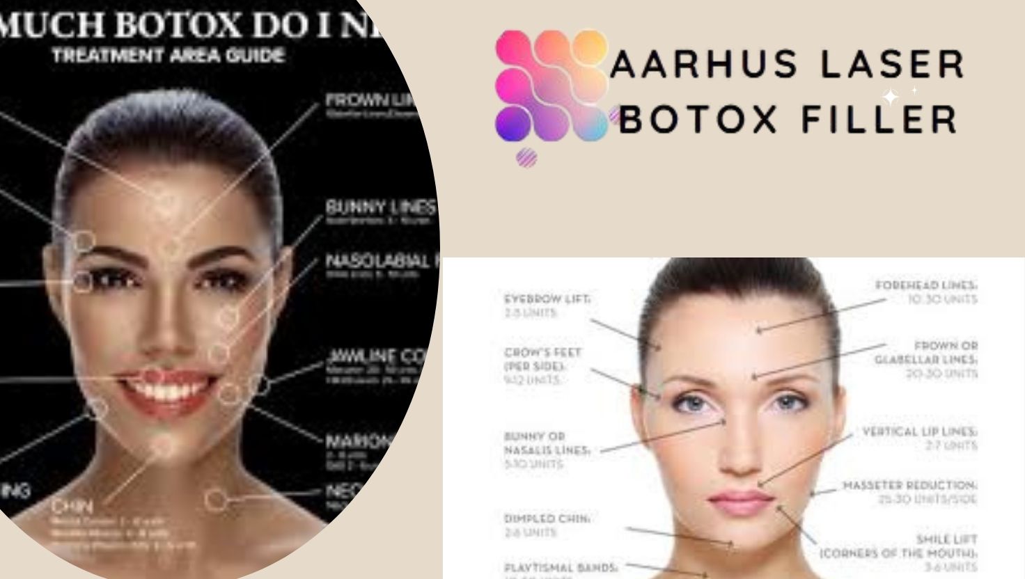 Botox near me prices