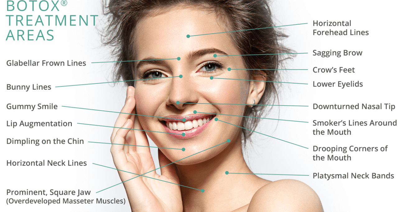 Botox-gesicht-1280x683.png