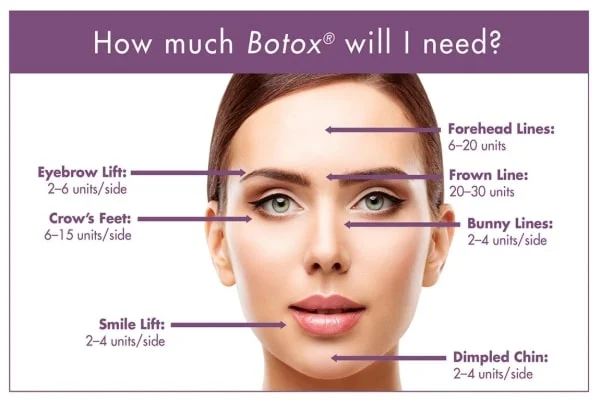 botox vorher nachher​